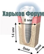 имплант03.jpg