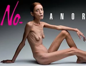 01anorexion.webp