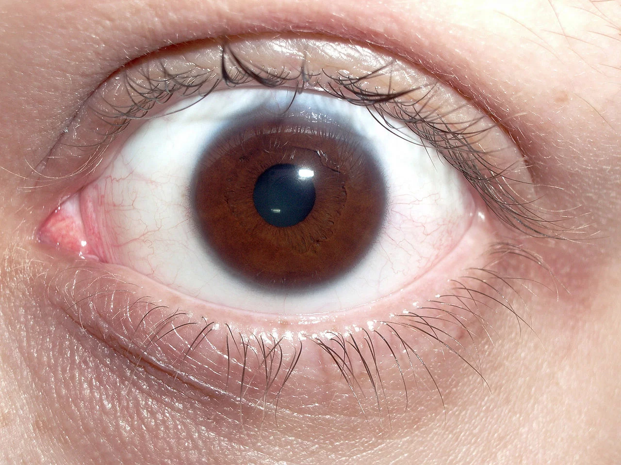 1280px-Brown_human_eye.webp