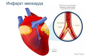 1741855890658.webp