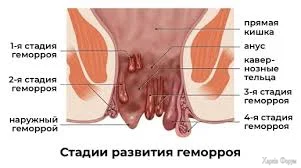 1781300439188.webp