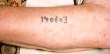 220px-Auschwitz_survivor_displays_tattoo_detail.webp