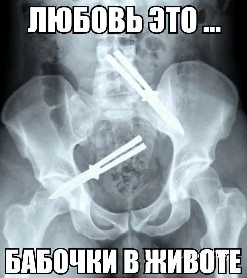 2a4b49b102d2714b412.webp