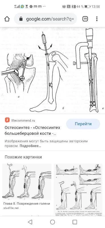 2fcb6c4f6b4325b37a960.webp