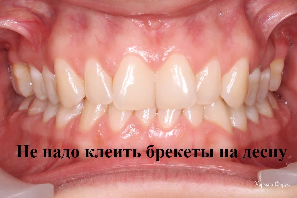 410e65c9f07f14dc.webp