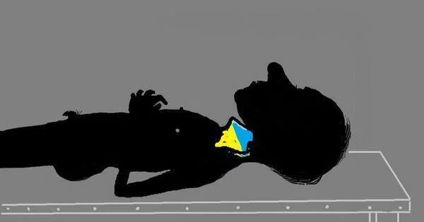 46aff05438935b4e927a2413acc5d822.webp