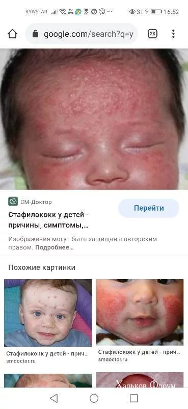 5a2279894eb852d503672.webp