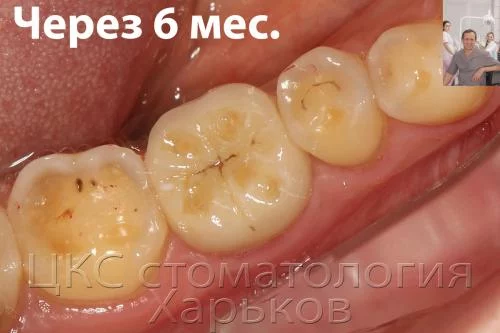 5chfac.webp