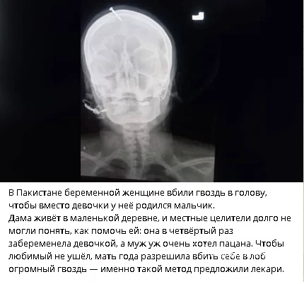 6ff9e500ef5cf7c8f634d07.webp