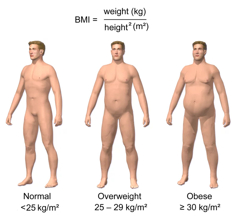 800px-Obesity_%26_BMI.webp