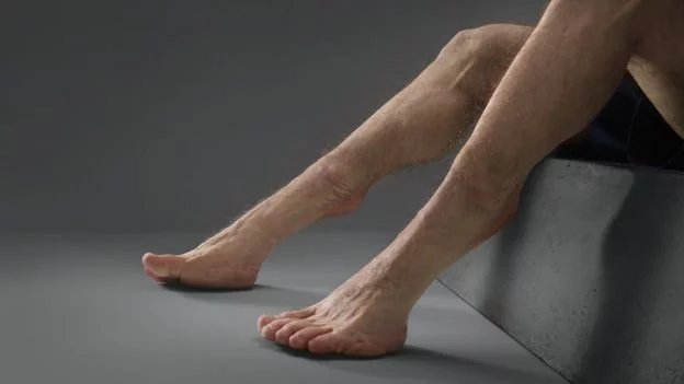 _90481742_grahamankle.webp