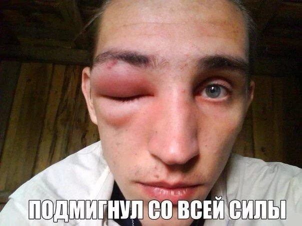 ahd0dd.webp