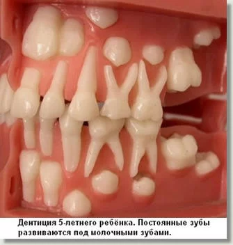 b3528a0fd87dd09f337fca439b9e58cb.webp