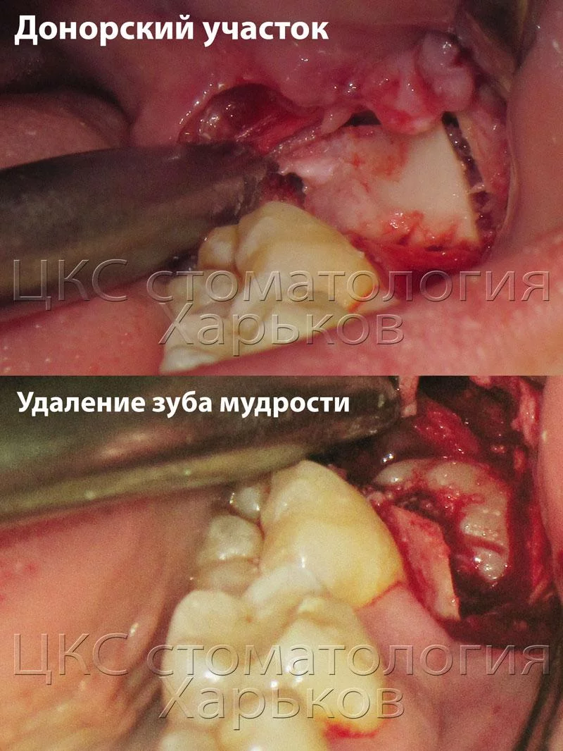 bl02.webp