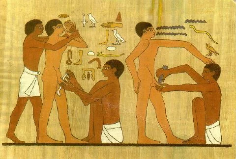 Circumcision_Sakkara_3.webp