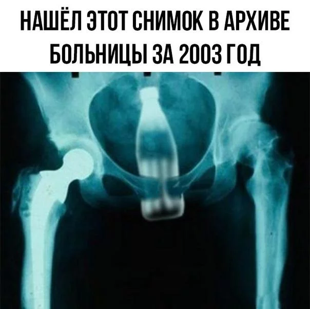 cjbg9h.webp