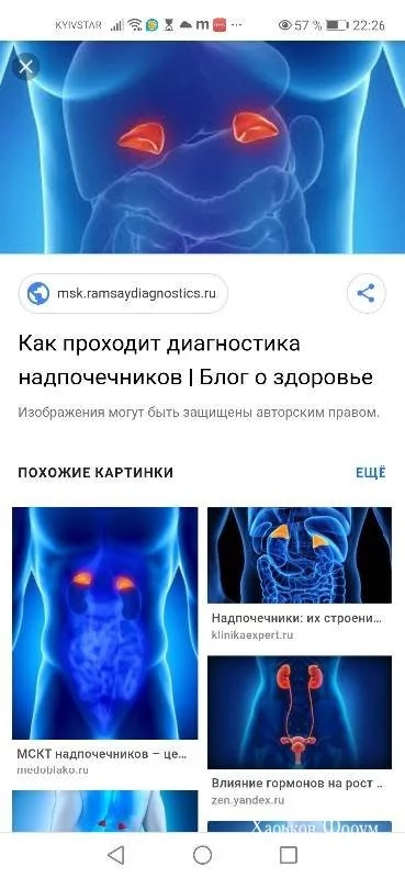 df99adb3488ac7e71f47.webp