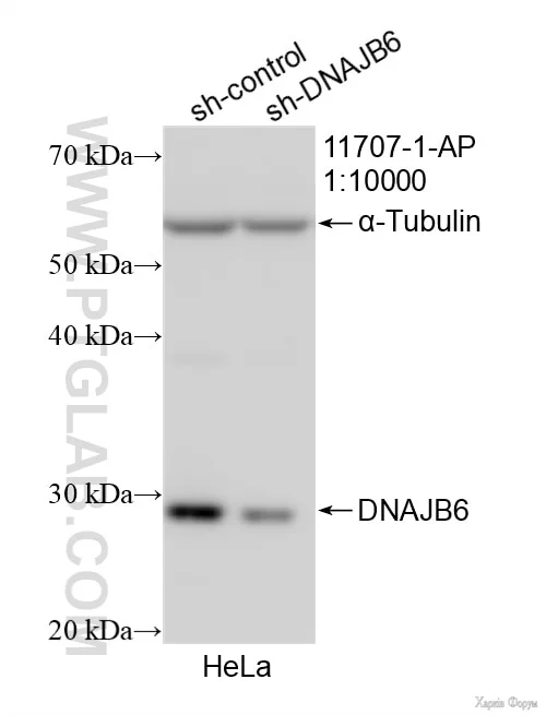 DNAJB6-Antibody-11707-1-AP-WB-523134.webp