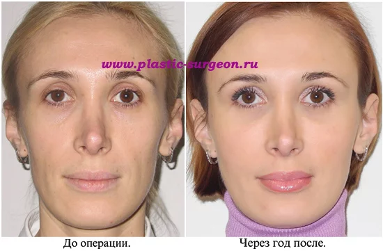 DSCN1971c.webp