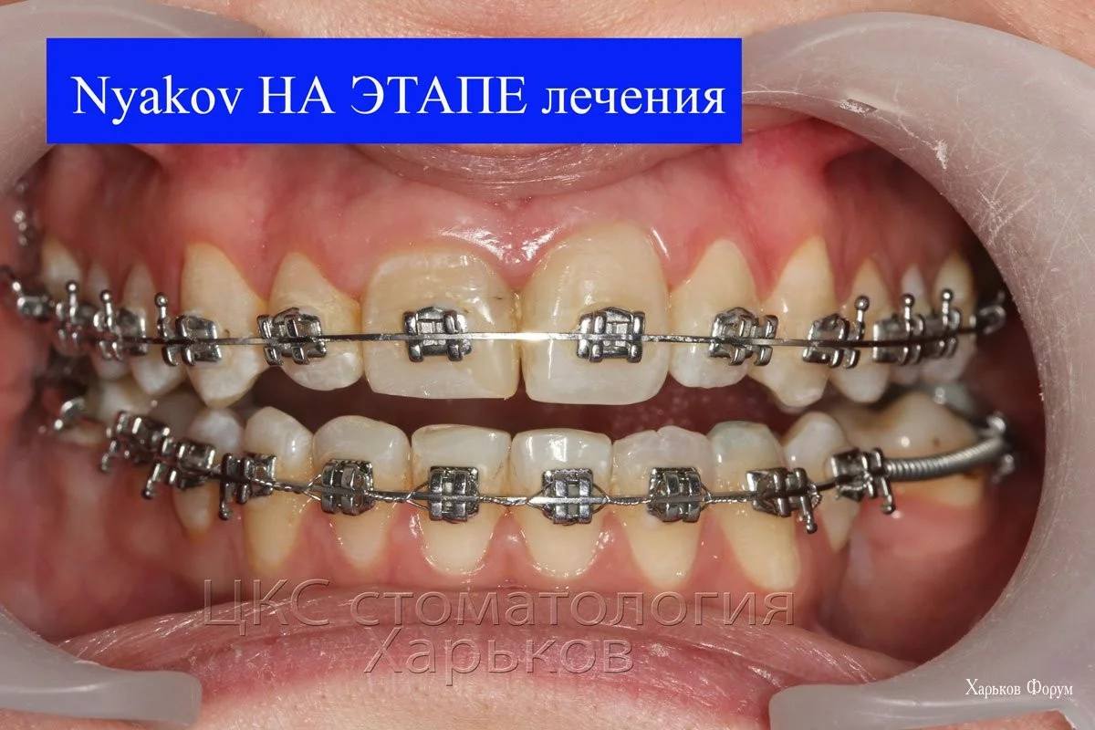 edd6410cb17827cd.webp