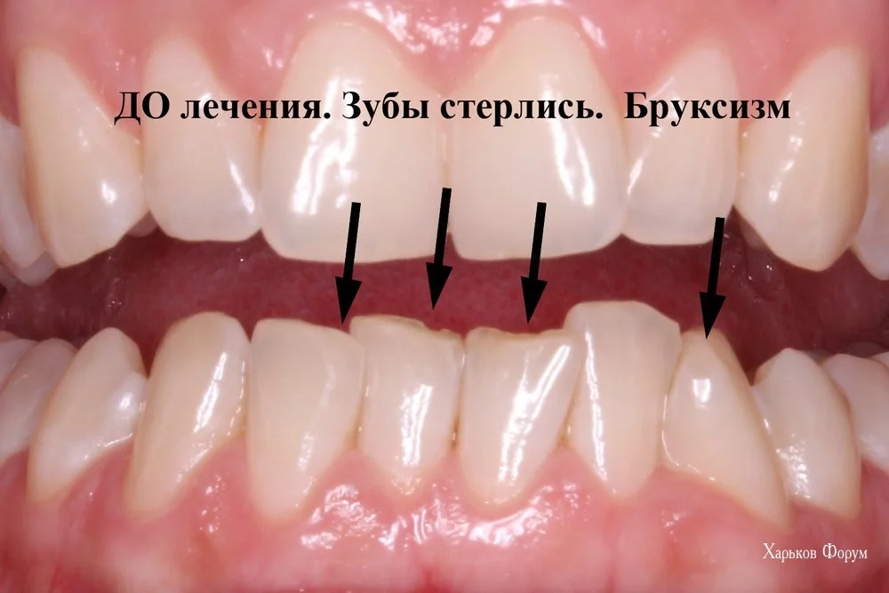 f12c1c3a998b3d83503f451e.webp