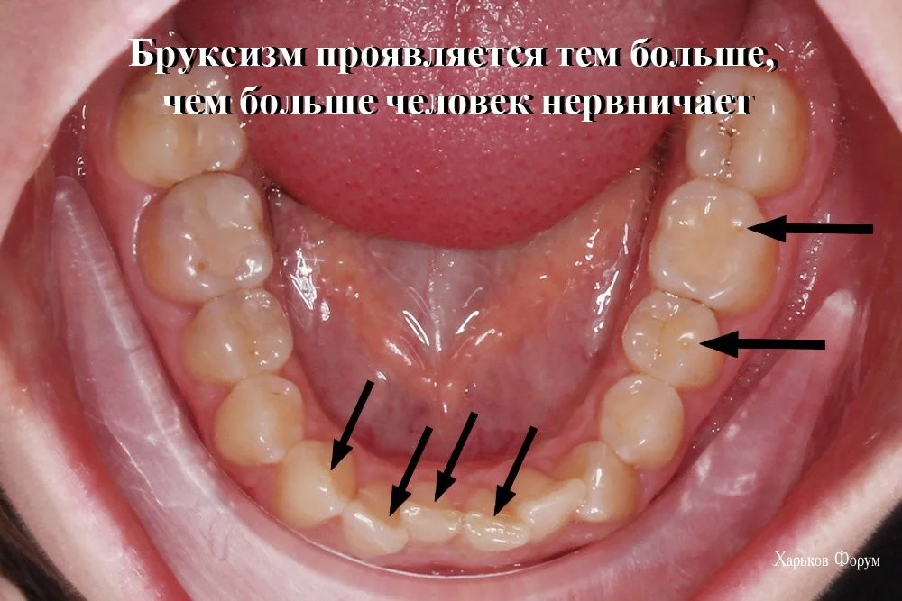 fac3421dae7a1d22c.webp