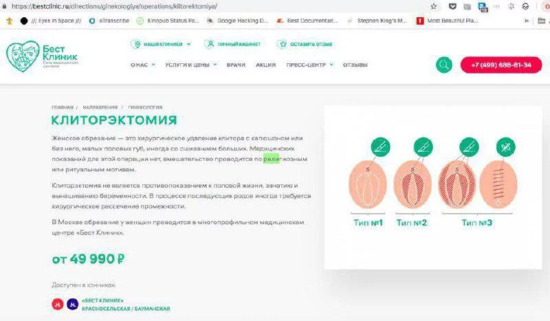 fbfh4j.webp