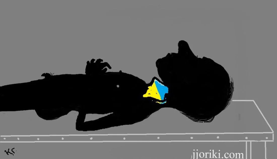 g9jbjc.webp