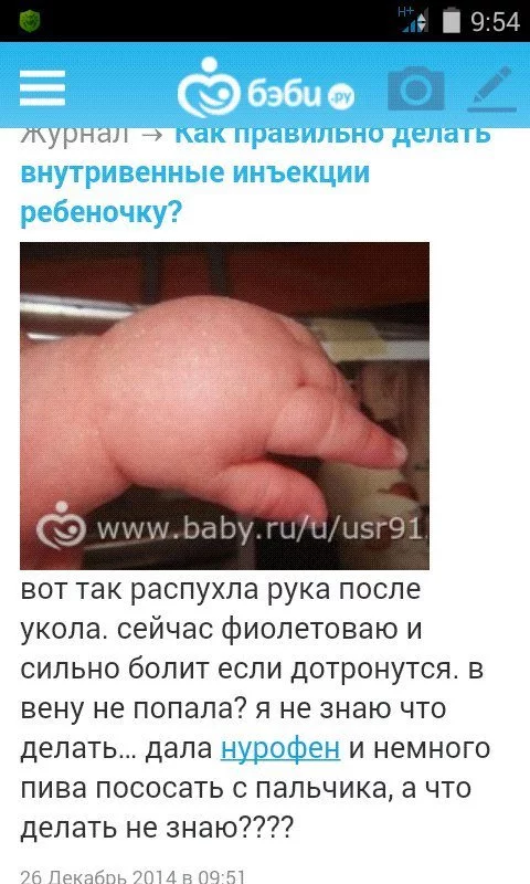hcb7fh.webp