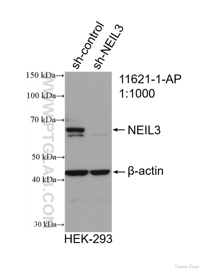 NEIL3-Antibody-11621-1-AP-WB-344998.webp