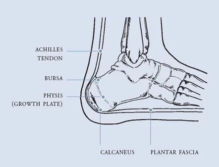 pic-ped-heel-pain.webp