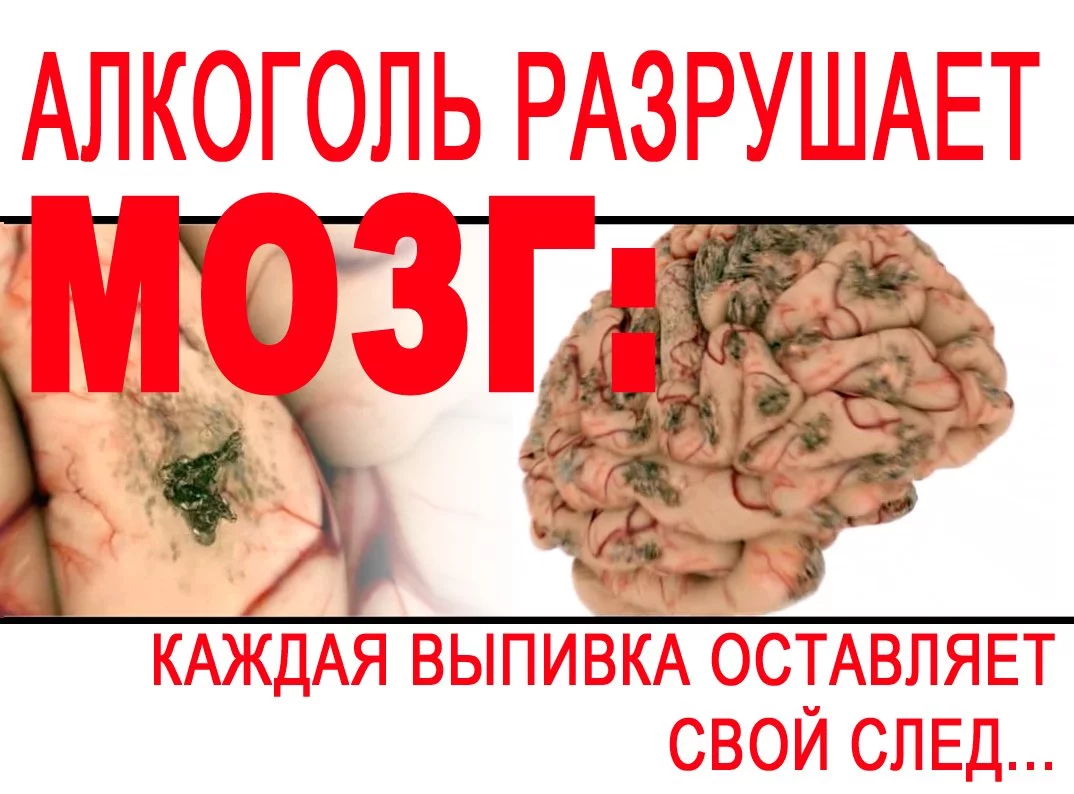 plakat-Alcohol_Razrushaet_Mozg.webp
