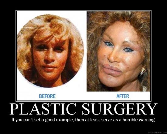 plastic-surgery-demotivational-post.jpg