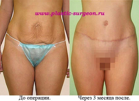 sonnikafas1.webp
