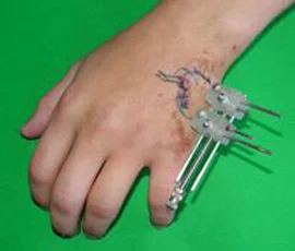 surgeryPict_8.webp