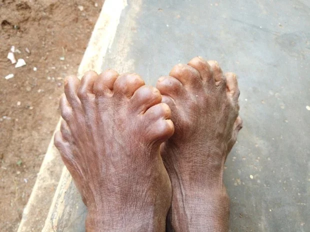SWNS_FINGERS_TOES_06JPG-JS558625.webp