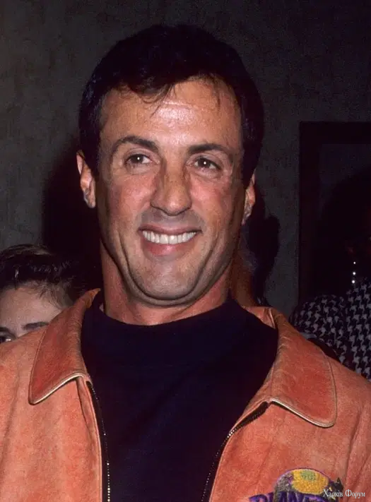 sylvester-stallone-teeth-in-1992.webp