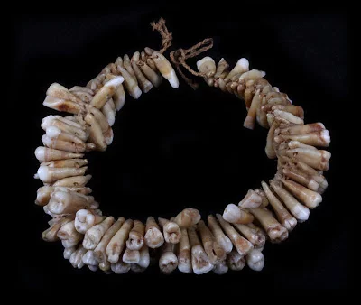 toothnecklace2.webp