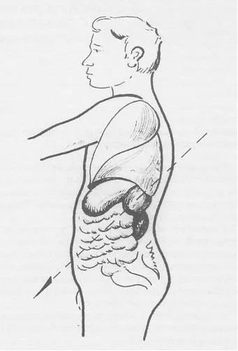 toracoabdominal.webp