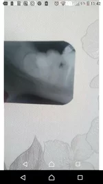 Screenshot_20180916-114208.jpg