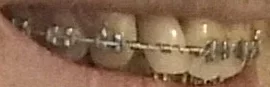 tooth2.webp