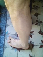 нога лыс_20190811_093045.jpg
