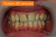 -лечения.webp