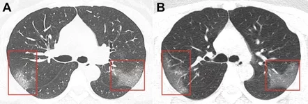 ct scan.webp