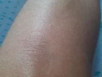 20201018_113331.webp