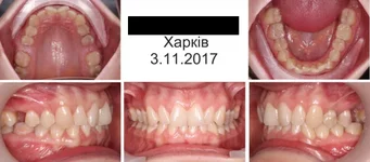 .webp