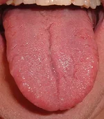 Tongue.agr.webp
