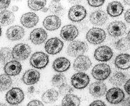 250px-HIV-1_Transmission_electron_micrograph_AIDS02bbb_lores.jpg