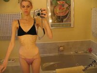 anorexia_53.jpg