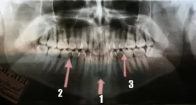 2222222 копия.webp